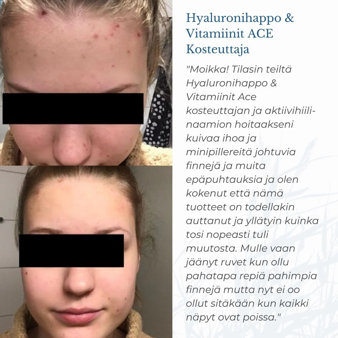 Tuotekuva 6